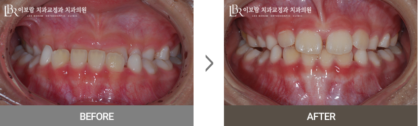 치료사례사진