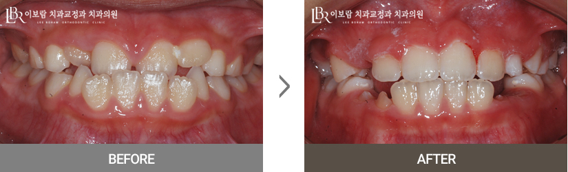 치료사례사진