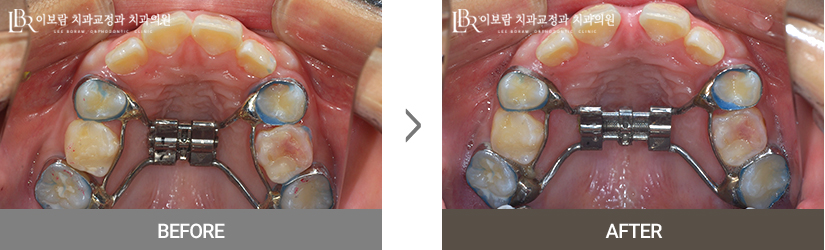 치료사례사진