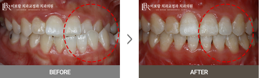 치료사례사진