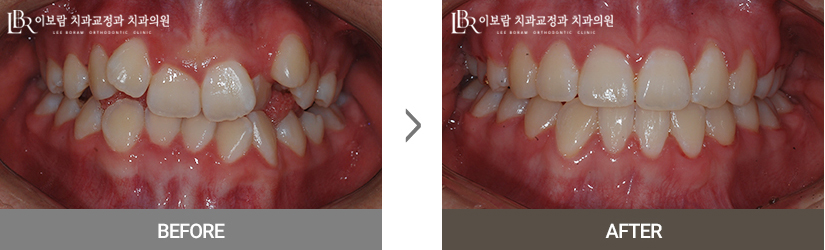 치료사례사진